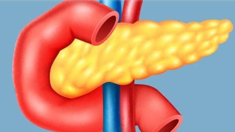 Ανεξήγητη μείωση βάρους και υπεργλυκαιμία είναι οι δύο ύποπτες ενδείξεις για έγκαιρη διάγνωση του καρκίνου του παγκρέατος